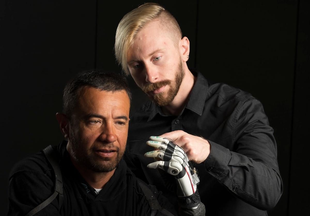 prótesis de mano biónica avanzada